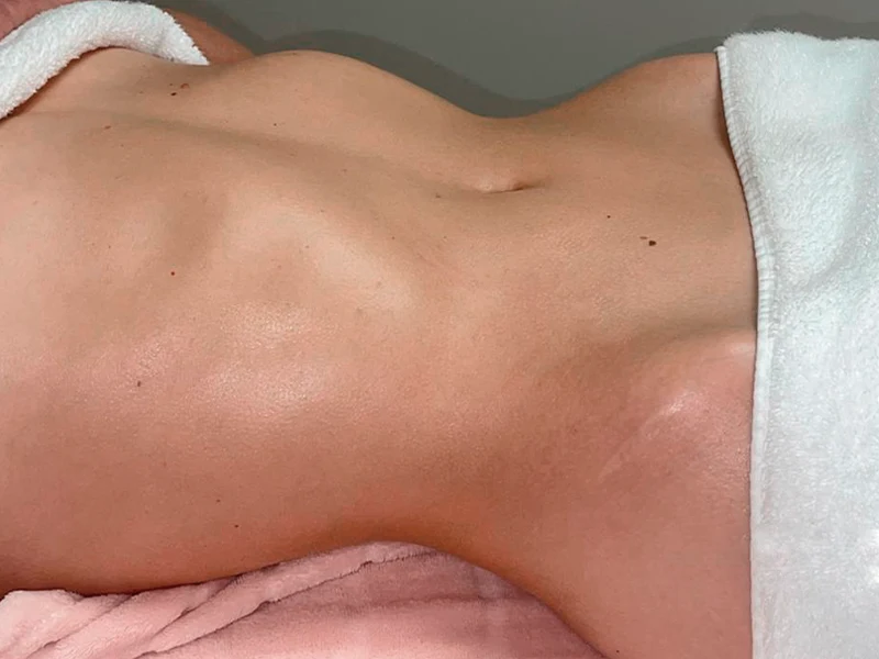 After - Authentic Brazilian Lymphatic in Austin, TX